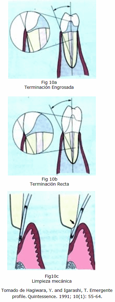 Agresion Gingival Con Los Procedimientos Restauradores