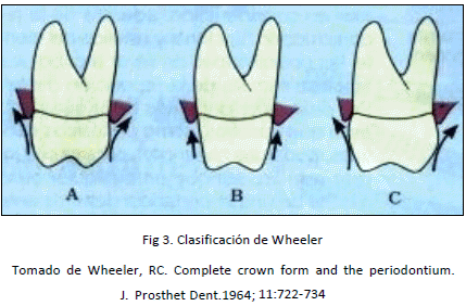 Agresion Gingival Con Los Procedimientos Restauradores