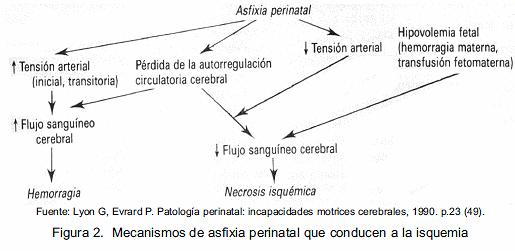 parálisis cerebral mixta