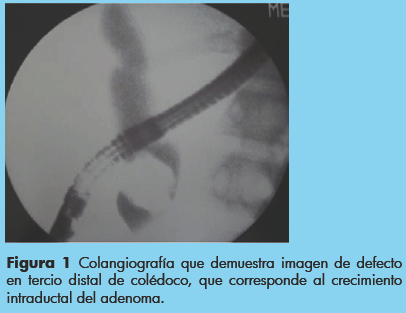 ampolla de vater histología