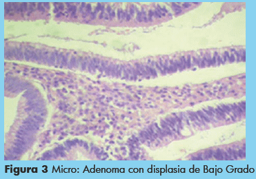 ampolla de vater histología