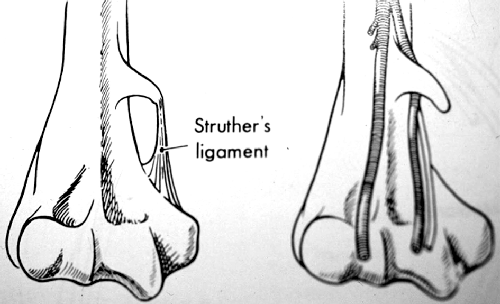 Guantes de compresión para artritisM. superior - Hombro, Brazo y mano