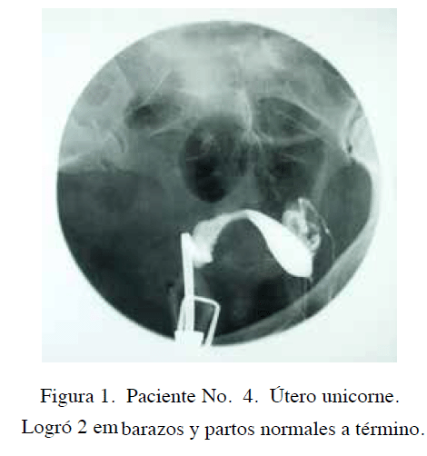 Útero Unicorne 4090