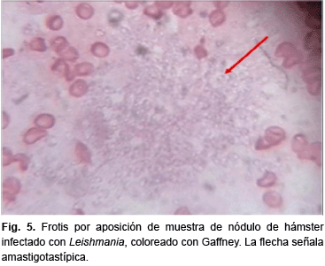 morfología de leishmania donovani