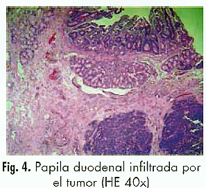 ampolla de vater histología