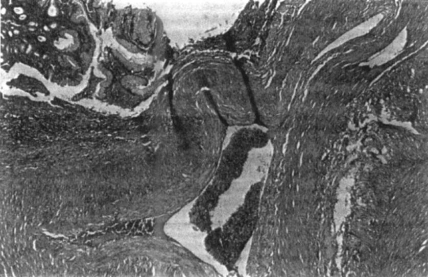 08 enfermedad 1.JPG (81474 bytes)