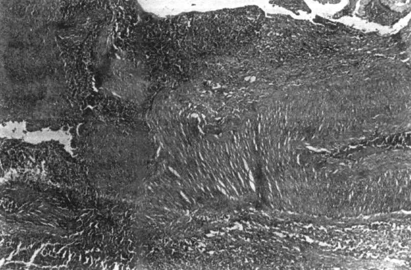 08 enfermedad 2.jpg (72922 bytes)