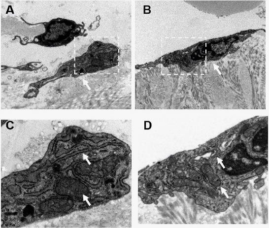 Hdpcs Cell Insulin-like growth factor-1 promotes the proliferation and odontogenic ...